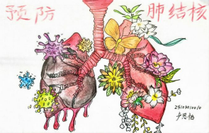 “肺”常守护,健康同行 ——我校红十字协会线上结核病防治系列作品征集比赛圆满落幕(图1) “肺”常守护,健康同行 ——我校红十字协会线上结核病防治系列作品征集比赛圆满落幕(图1)