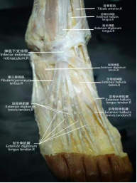 技展赛场，学汇新疆——我校学子在中第十二届全国解剖学技术学术会议暨人体解剖标本制作大赛中斩获佳绩(图3)